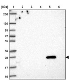 Lane 1: Marker [kDa] 250, 130, 95, 72, 55, 36, 28, 17, 10_br/_Lane 2: Human cell line RT-4_br/_Lane 3: Human cell line U-251 MG_br/_Lane 4: Human plasma_br/_Lane 5: Human Liver tissue_br/_Lane 6: Human Tonsil tissue
