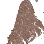 Immunohistochemical staining of human cerebral cortex shows moderate positivity in neuropil.