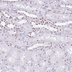 Immunohistochemical staining of human kidney shows moderate nuclear positivity in cells in tubules.