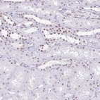 Immunohistochemical staining of human kidney shows moderate nuclear positivity in cells in tubules.
