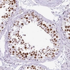 Immunohistochemical staining of human testis shows strong nuclear positivity in cells in seminiferous ducts.