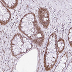 Anti-FAM122A Antibody