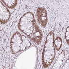 Immunohistochemical staining of human rectum shows strong nuclear positivity in glandular cells.