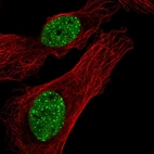 Immunofluorescent staining of human cell line U-2 OS shows localization to nucleoplasm & nuclear bodies.
