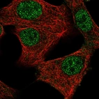 Immunofluorescent staining of human cell line A549 shows localization to nucleoplasm.