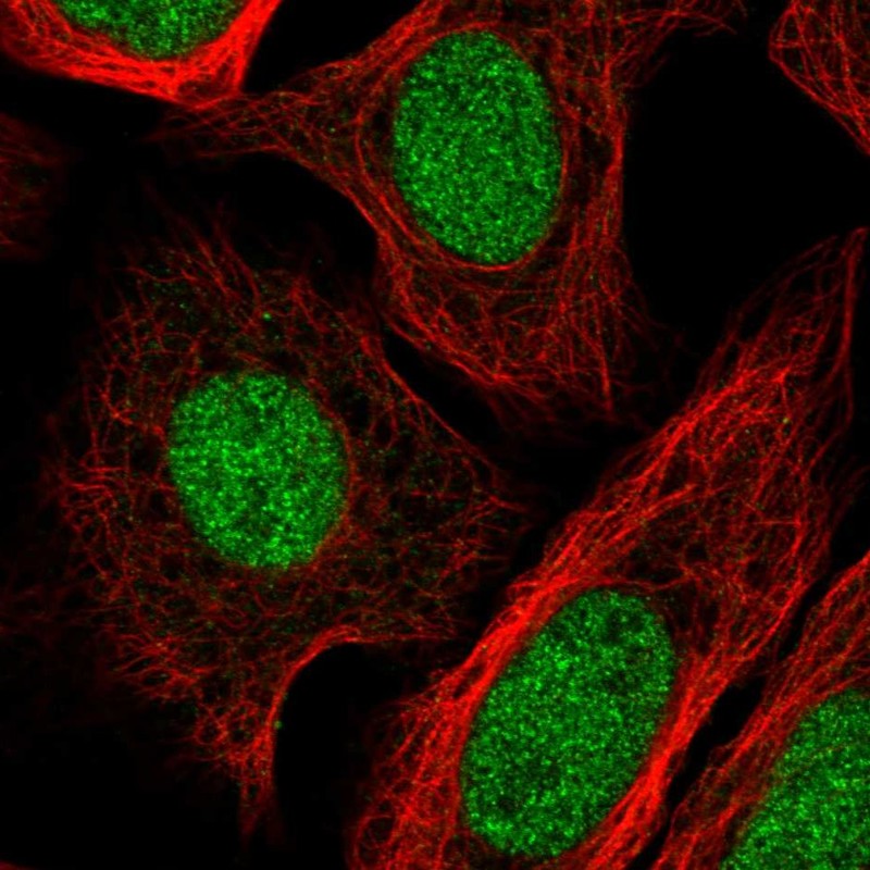 Anti-GTF2IRD2B Antibody