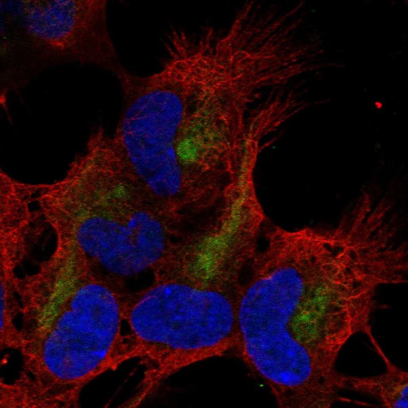 Anti-ZMAT4 Antibody