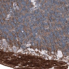 Immunohistochemical staining of human cerebellum shows strong positivity in neuropil.