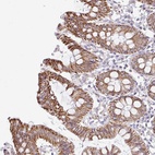 Anti-NT5C1B Antibody