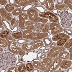 Anti-RDH14 Antibody