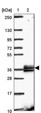 Anti-RDH14 Antibody