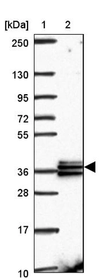Lane 1: Marker [kDa] 250, 130, 95, 72, 55, 36, 28, 17, 10_br/_Lane 2: Human cell line RT-4