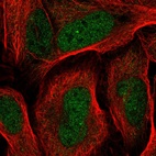 Immunofluorescent staining of human cell line U-2 OS shows localization to nucleoplasm.