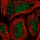 Anti-RDH14 Antibody