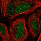 Immunofluorescent staining of human cell line U-2 OS shows localization to nucleoplasm.
