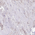 Immunohistochemical staining of human skeletal muscle shows no positivity in myocytes as expected.