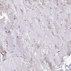 Immunohistochemical staining of human skeletal muscle shows no positivity in myocytes as expected.