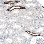 Immunohistochemical staining of human kidney shows strong membranous positivity in a subset of cells in tubules.