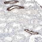 Immunohistochemical staining of human kidney shows strong membranous positivity in a subset of cells in tubules.