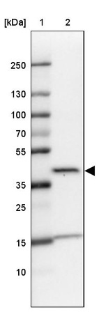 Lane 1: Marker [kDa] 250, 130, 100, 70, 55, 35, 25, 15, 10_br/_Lane 2: Human cell line U-87 MG