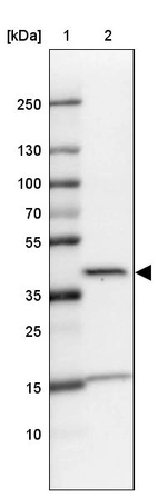 Lane 1: Marker [kDa] 250, 130, 100, 70, 55, 35, 25, 15, 10_br/_Lane 2: Human cell line U-87 MG