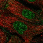 Immunofluorescent staining of human cell line CACO-2 shows localization to nucleus & plasma membrane.