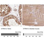 Anti-STRN4 Antibody