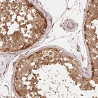Immunohistochemical staining of human testis shows high expression.