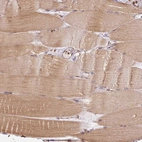 Immunohistochemical staining of human skeletal muscle shows low expression as expected.