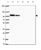 Lane 1: Marker [kDa] 250, 130, 95, 72, 55, 36, 28, 17, 10_br/_Lane 2: Human cell line RT-4_br/_Lane 3: Human cell line U-251 MG_br/_Lane 4: Human plasma_br/_Lane 5: Human Liver tissue_br/_Lane 6: Human Tonsil tissue