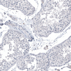 Anti-L1CAM Antibody