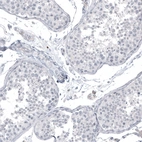 Immunohistochemical staining of human testis shows no positivity in cells in seminiferous ducts as expected.