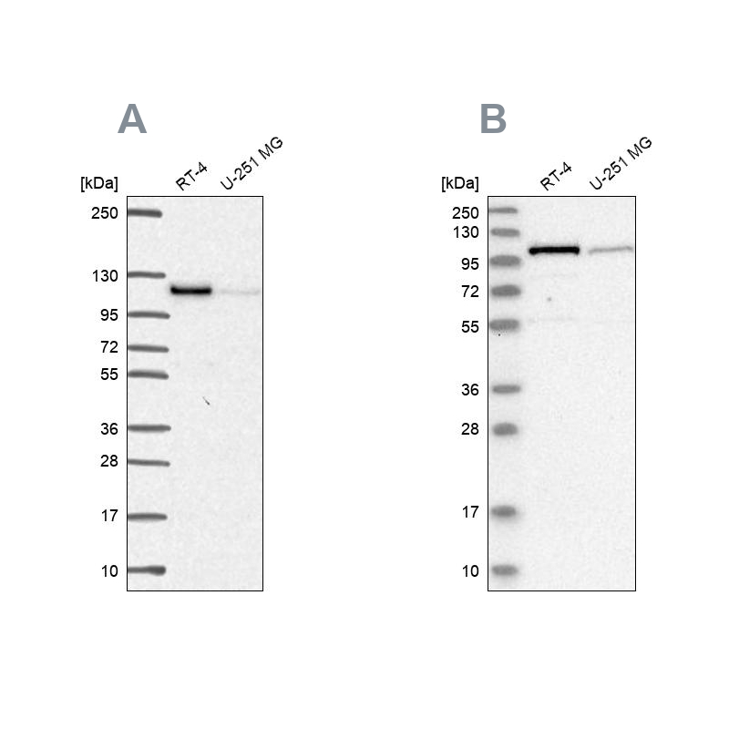 Anti-PRKD2 Antibody