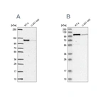 Anti-PRKD2 Antibody
