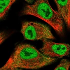 Immunofluorescent staining of human cell line A549 shows localization to nucleoplasm & cytosol.