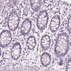 Immunohistochemical staining of human colon shows low expression as expected.