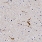 Immunohistochemical staining of human cerebral cortex shows high expression.