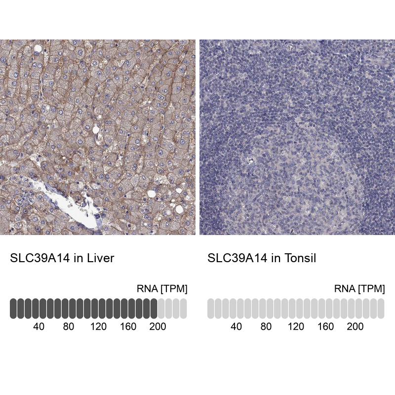 Anti-SLC39A14 Antibody