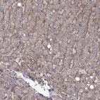Immunohistochemical staining of human liver shows high expression.