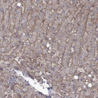 Immunohistochemical staining of human liver shows high expression.