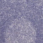 Anti-SLC39A14 Antibody