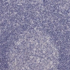Immunohistochemical staining of human tonsil shows low expression as expected.