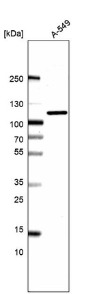 Anti-AP2B1 Antibody