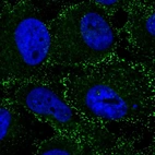 Immunofluorescent staining of human cell line U-251 MG shows localization to vesicles.