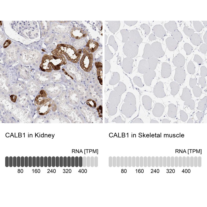 Anti-CALB1 Antibody