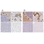 Immunohistochemical staining of human cerebellum, kidney, pancreas and skeletal muscle using Anti-CALB1 antibody HPA056734 (A) shows similar protein distribution across tissues to independent antibody HPA023099 (B).