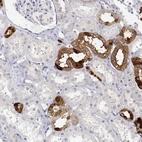 Immunohistochemical staining of human kidney shows strong nuclear and cytoplasmic positivity in cells in tubules.