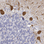 Immunohistochemical staining of human cerebellum shows strong cytoplasmic positivity in Purkinje cells.