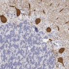 Immunohistochemical staining of human cerebellum shows strong cytoplasmic positivity in Purkinje cells.
