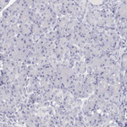 Immunohistochemical staining of human pancreas shows no positivity in exocrine glandular cells as expected.
